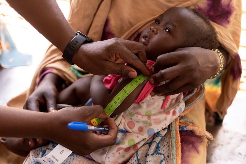 A baby is checked for malnutrition at the Médecins Sans Frontières hospital in Adre’s refugee camp, near Chad's  border with Sudan. 
Photograph: Chris Maddaloni